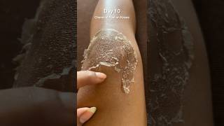 Chemical peel on knees Day 10 #chemicalpeel #chemicalpeeling #chemicalpeeljourney #tcapeel #peels screenshot 5