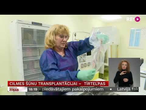 Cilmes šūnu transplantācijai –  tīrtelpas