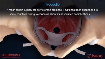 New #UOGJournal video abstract on the role of mesh surgery in management of women with prolapse
