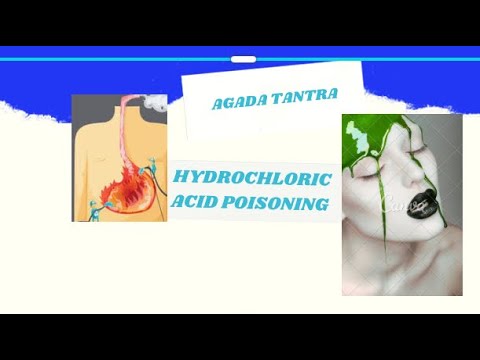 HYDROCHLORIC ACID POISONING