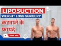 What is liposuction liposuction surgery for weight loss  process types cost results  recovery