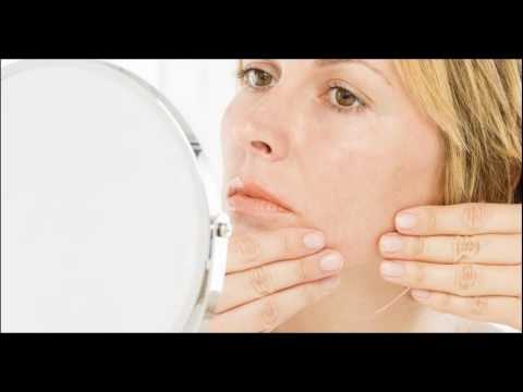 Causes Of Chin Hair And Acne in Women And Men