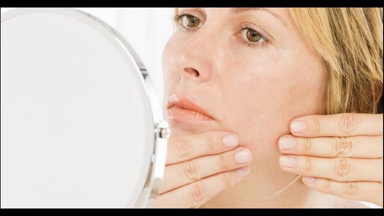 Causes Of Chin Hair And Acne In Women And Men YouTube