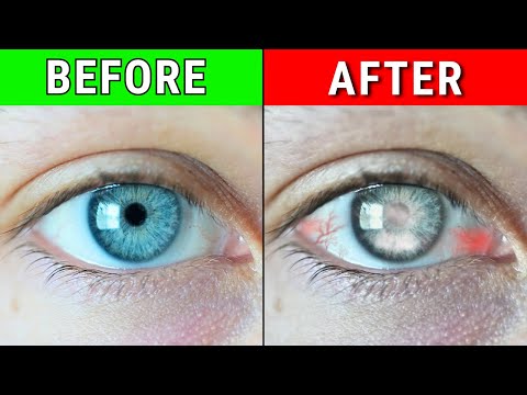 Video: Jak si udržet zdravé oči při používání dekorativních čoček