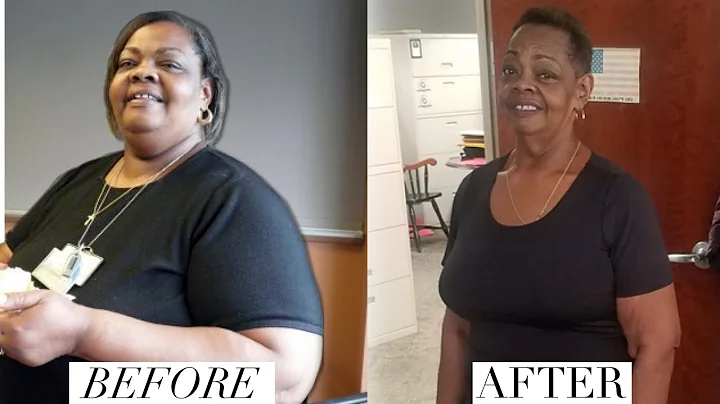 Carolyn Perry Loses 175lbs with More Active Lifest...