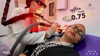 جلسات إزالة الشعر بالليزر بجهاز ديكا بعيادات كتاليا للتجميل والليزر