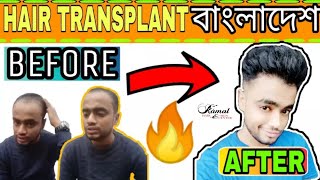 Hair Transplant Bangladesh -|| Kamal Hair And Skin Center ||