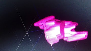 3D finished model of Natalies tumor using ITK-snap.