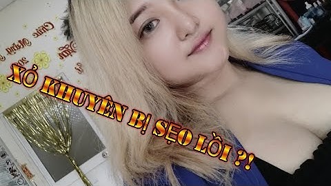 Xỏ khuyên rốn bị lồi thịt