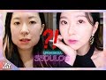 WHAT HAPPENED TO MY FACE?! │Cosmetic Procedures in Korea