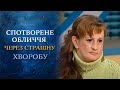 Мою дочь изуродовала болезнь! (полный выпуск) | Говорить Україна