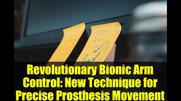 Revolutionary Bionic Arm Control: New Technique for Precise Prosthesis Movement