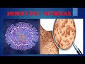 What is mpox?