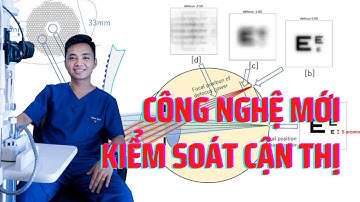 Các loại kính kiểm soát cận thị tiến triển công nghệ mới nhất 2022 | OptomDang