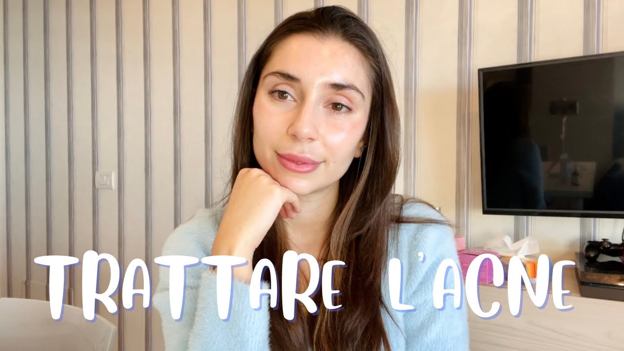 COME TRATTO UNA PELLE ACNEICA IN CONSULENZA || GUIDA PRATICA