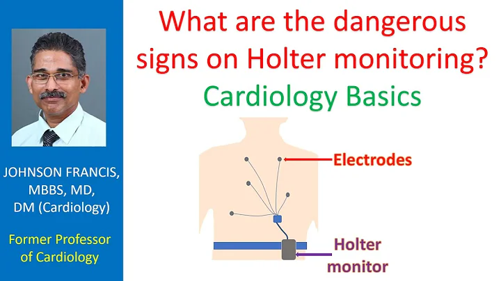 What are the dangerous signs on Holter monitoring? Cardiology Basics