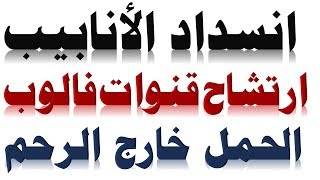 انسداد الانابيب و تاخر الحمل و الحمل خارج الرحم | اسباب انسداد الأنابيب و ارتشاح الانابيب | الأنابيب