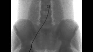 Interventional radiology simulation