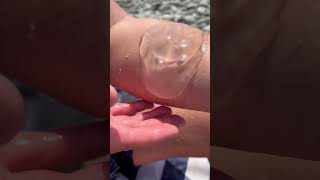 🏖 Черноморские #медузы опасны?