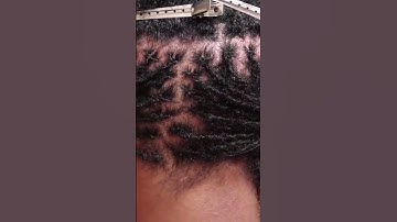 #microlocs #locs #locstyles micro locs
