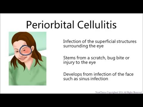 Video: Er periorbital cellulitt en nødsituasjon?