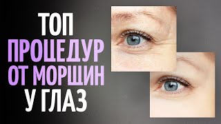Самые эффективные процедуры от морщин у глаз