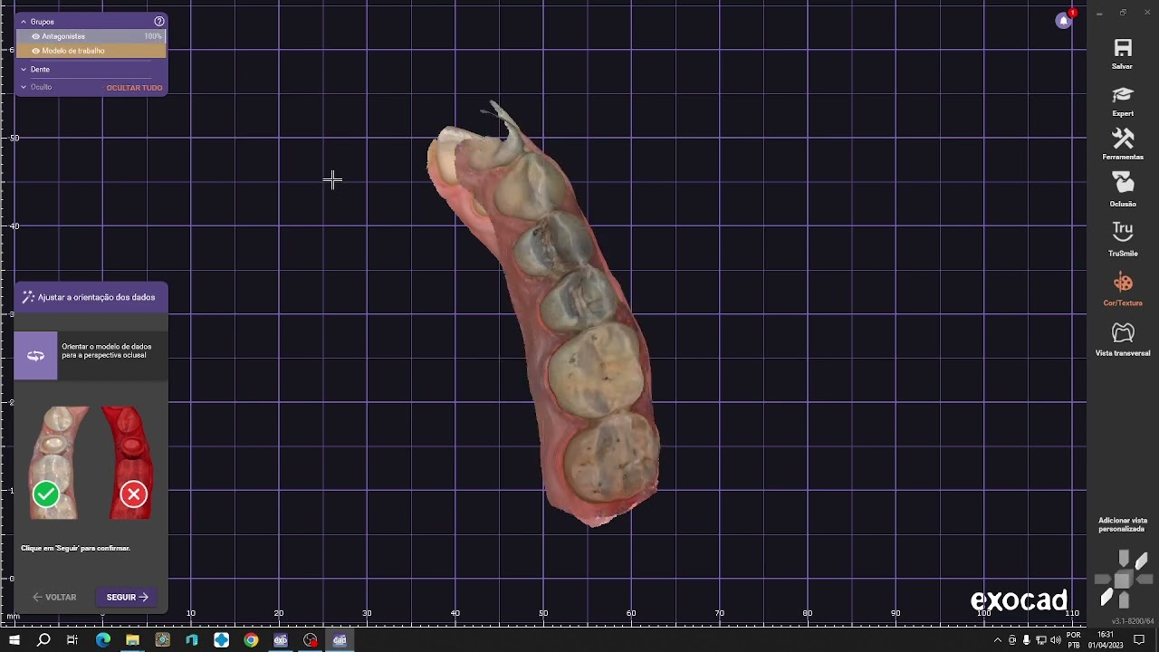 Exocad iniciante coroa anatômica dicas e atalhos