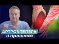 АРТРОЗ СУСТАВОВ лечение коленного сустава