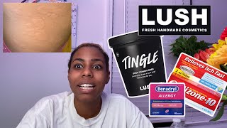 I had an allergic reaction from a Lush Product