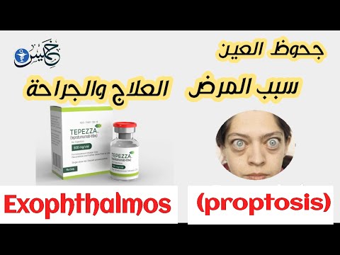 جحوظ العين السبب احدث العلاجات بدون جراحة الجراحة