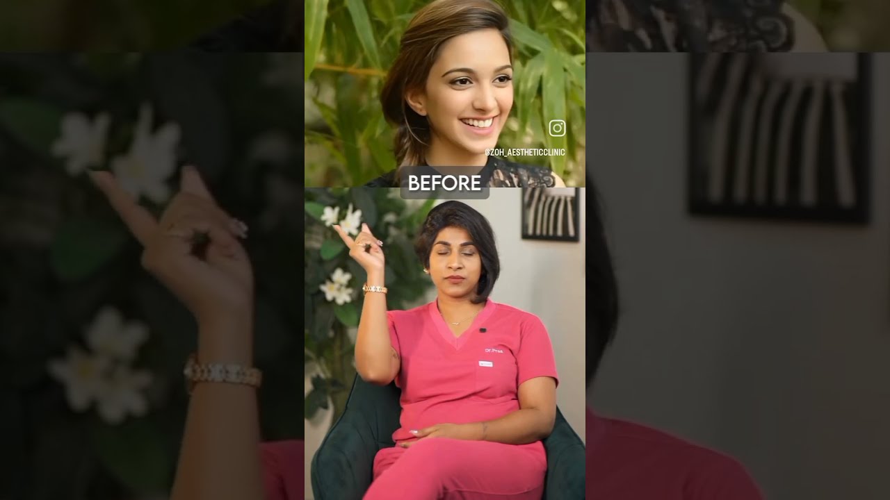 Kiara Advani Surgery Foryou Cosmeticsurgery Youtubeshorts Surgerytips Bollywood