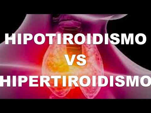Video: ¿El hipoparatiroidismo y el hipotiroidismo son lo mismo?