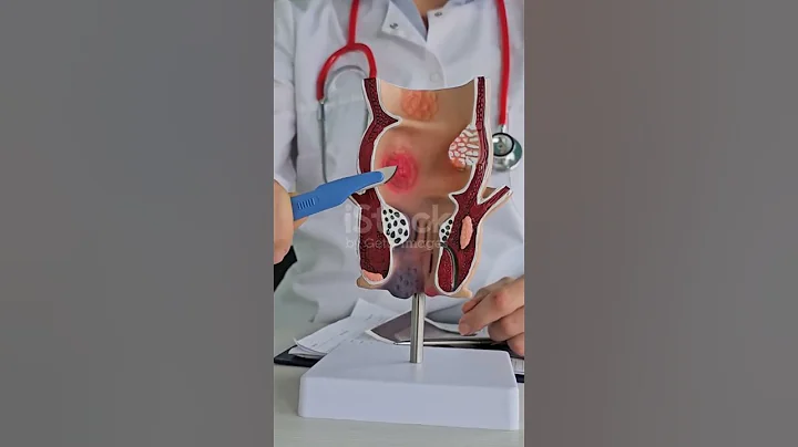 colonoscopy Colonoscopy Procedure Explained | Preparation, Benefits & Risks