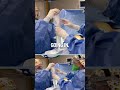 Dr beverly fischers brekka implant insertion surgical footage