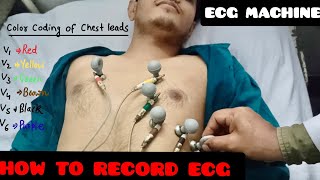 How To Record ECG | ECG leads Color Coding And Placement Location | ECG Machine