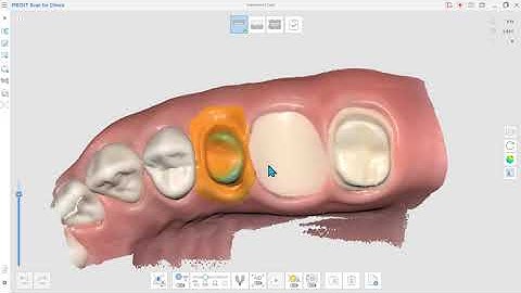 Impression Scan (ENG)