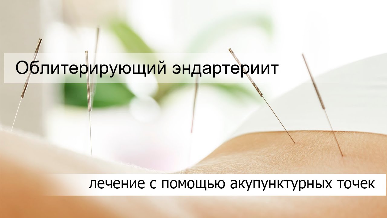 ОБЛИТЕРИРУЮЩИЙ ЭНДАРТЕРИИТ. ОБЛИТЕРИРУЮЩИЙ ЭНДАРТЕРИИТ.