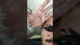 Removing Tattoos On Face