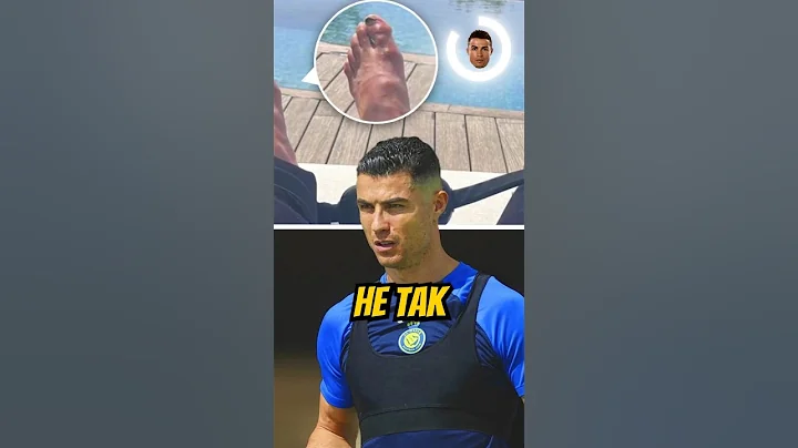 🤢🤮НОГИ РОНАЛДУ, МЕССИ И НЕЙМАРА⚽️ #интересныефакты #ronaldo #футбол #спорт