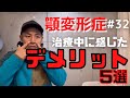 【顎変形症#32】デメリット5選【治療/手術/矯正】