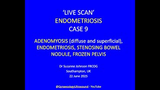 LIVE SCAN 9