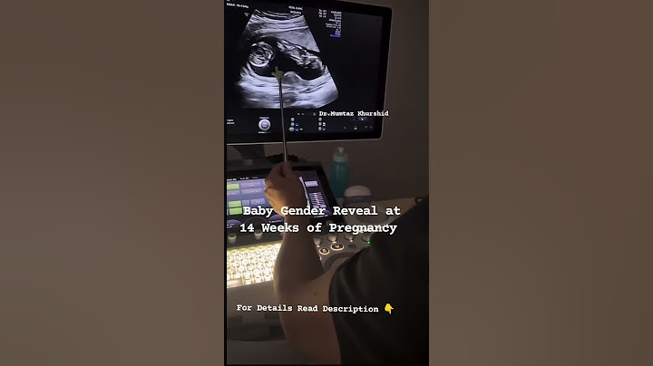 12 Weeks Pregnancy Gender Reveal | Baby Boy or Girl? Early Ultrasound Explained!