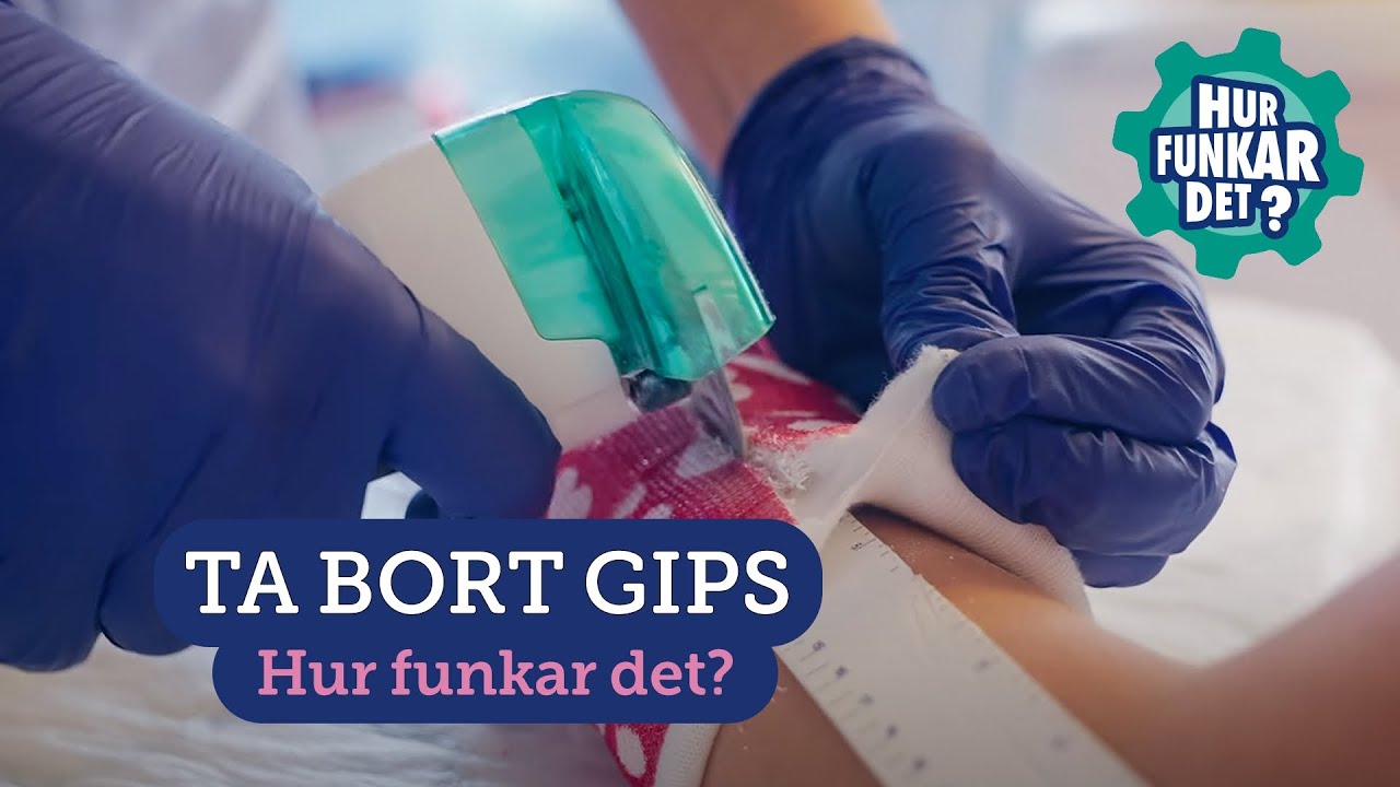 Ta bort gips på armen med en såg (ungdom)