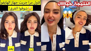 تجهيزات العيد | جهاز الهايفو على وجهي ما صدقت النتيجة!!😱 شوفو الفرق😳🔥 #عائلة_ميرو