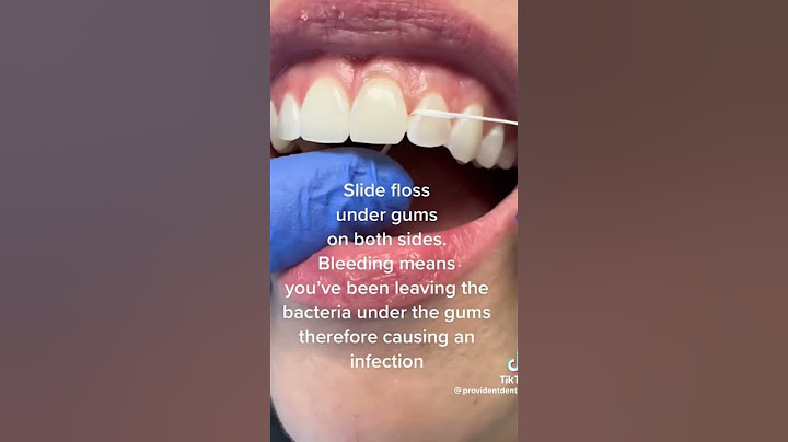 Are you flossing properly? #dentaltips #dentaleducation