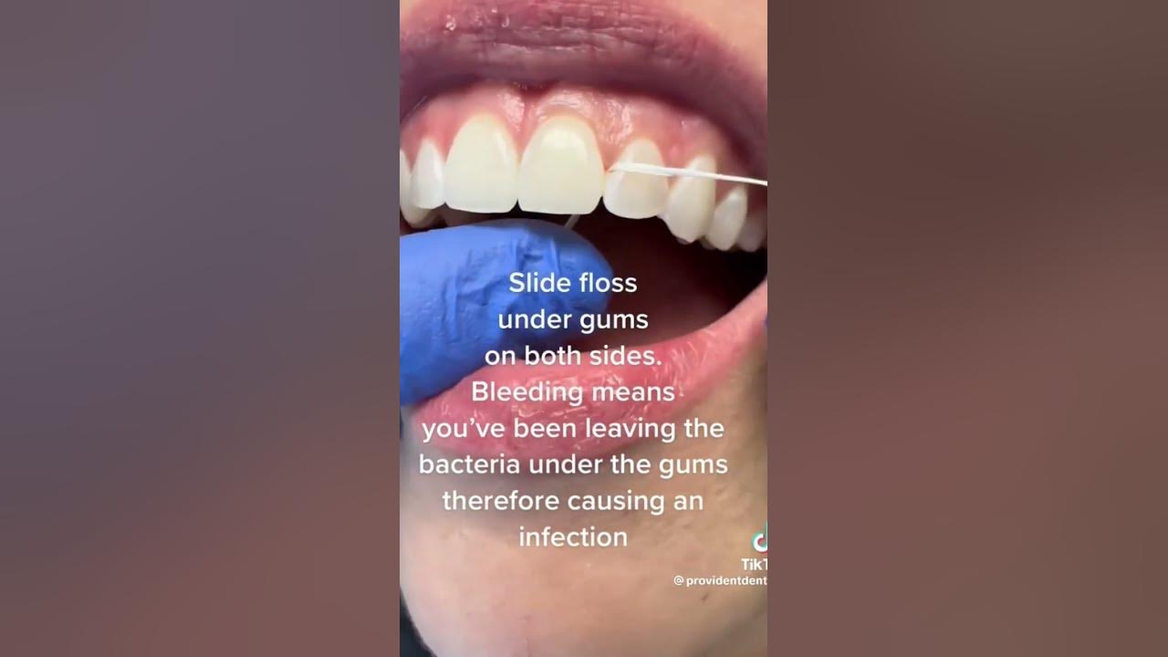 Are you flossing properly? #dentaltips #dentaleducation
