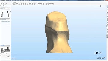 3Shape Coping in less than 2 min Demo