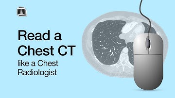 How to Read a Chest CT