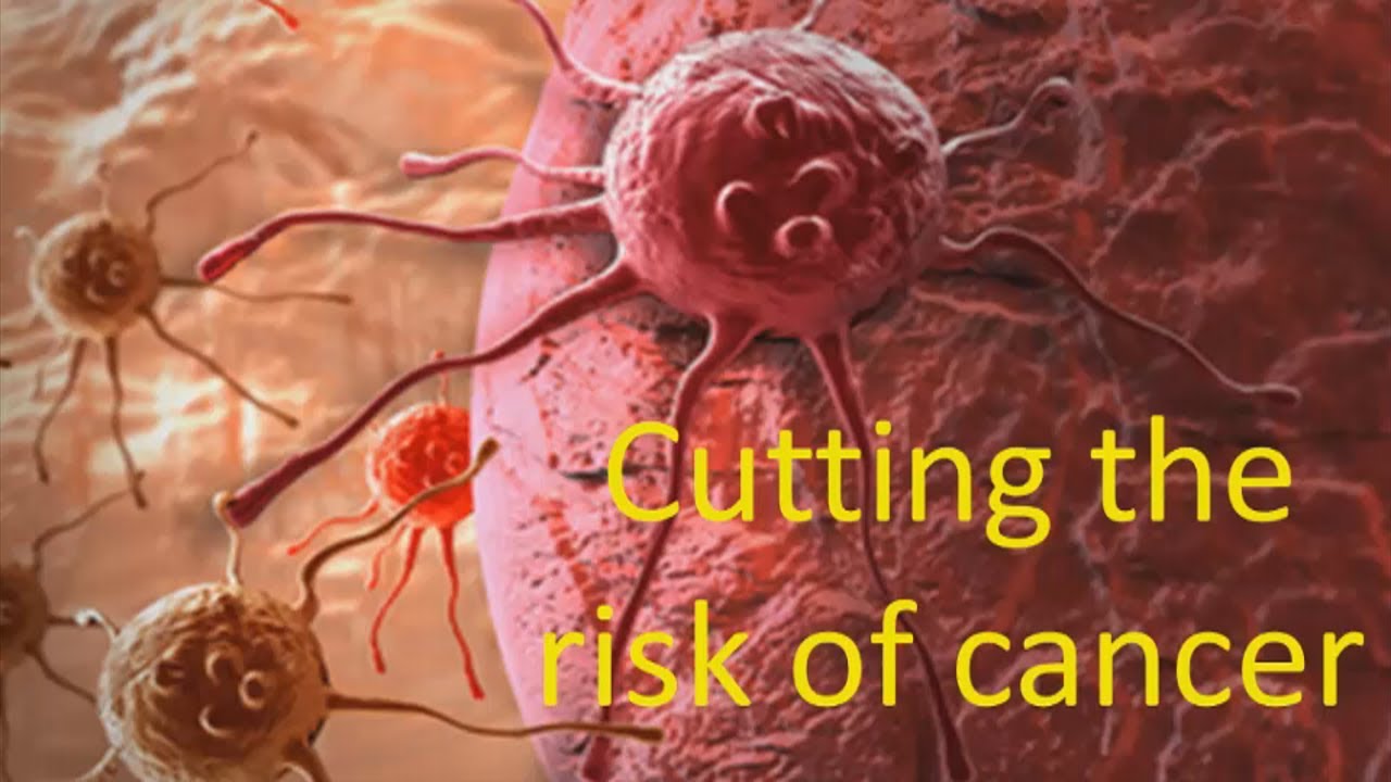 You can cut the risk of cancer    Dr Paul Clayton