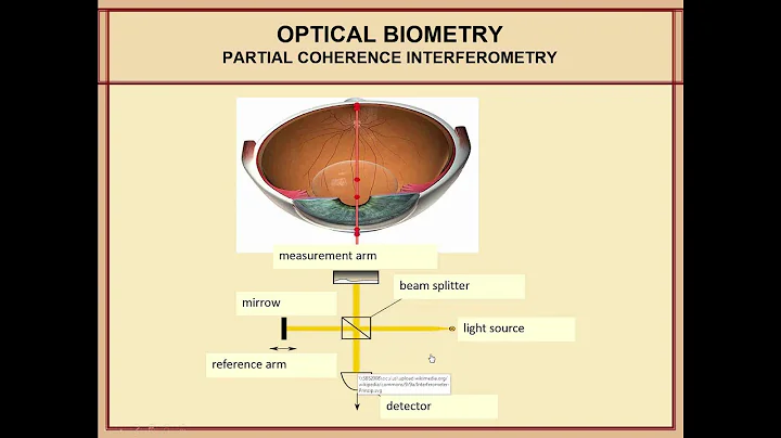 [Online Seminar] H John Shammas: Improving Catarac...